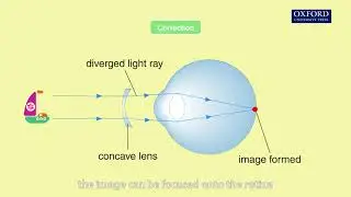 Animation 15.5 Short sight and long sight