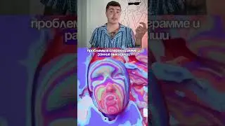 ВАРИКОЦЕЛЕ И ТЕСТОСТЕРОН МОЙ ОПЫТ И АНАЛИЗЫ ДО И ПОСЛЕ ОПЕРАЦИИ 💊 