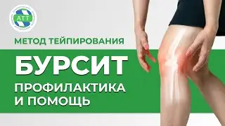 ✅ Бурсит коленного сустава | Тейпирование колена | Бурсит лечение