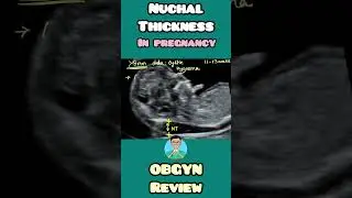 Nuchal thickness in pregnancy | prenatal USG scan explained for #usmle #inicet #neetpg #nclex