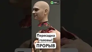 Пересадка головы!🤯прорыв! #здоровье #медицина #омоложение #уколыкрасоты #морщины #топ #ботокс #акне