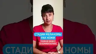 🔴 Меланома 1, 2, 3 и 4 стадия рака кожи. Как быстро развивается меланома