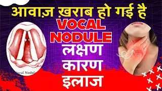 वोकल नोड्यूल : लक्षण, कारण, इलाज Vocal Cord Nodule Symptoms, Reasons, Treatment Cause of Sore Voice