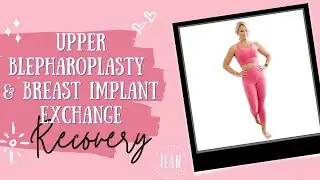 Upper Blepharoplasty, fat graphing and breast implant exchange recovery