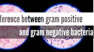 Difference Between Gram Positive And Gram Negative Bacteria With Respect To Gram Staining In Urdu