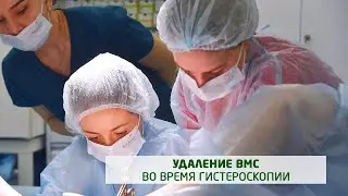 Гистероскопия: удаление ВМС