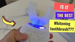 uSmile Teeth Whitening Unboxing