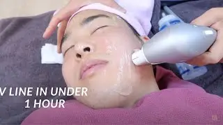 This Is What A Non-Surgical Face Lift Looks Like | Seoul Guide Medical