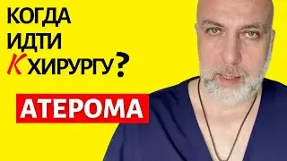 Атерома (жировик и киста) - когда идти к хирургу | Доктор Елизаров: удаление атеромы лазером