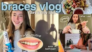 a day in my life with BRACES ❄️ (vlog, what i eat, braces routine, pain, q&a, tips & advice, etc)