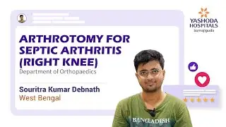 Arthrotomy for Septic Arthritis (Right Knee)| Yashoda Hospitals Hyderabad