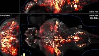 Whole-brain Imaging of Neuronal Activity with Cellular Resolution