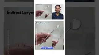 Direct and Indirect Laryngoscopy 