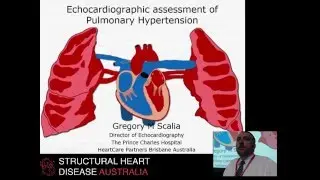 Echocardiographic assessment of pulmonary hypertension - Prof Greg Scalia