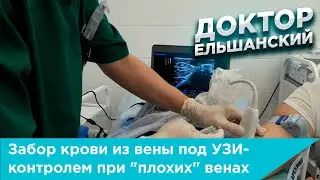 Забор крови из вены под УЗИ-контролем при 