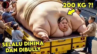 GADIS SEBERAT 200 KG SELALU DIHINA & DIBULLY SAMPAI DIA MEMILIH CARA EKSTRIM UNTUK MENJADI CANTIK