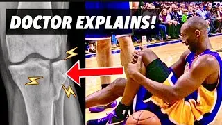 Doctor Explains how Kobe Bryant BROKE his LEG after Achilles Rupture