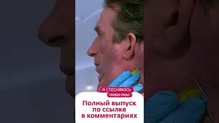 ГИГАНТСКИЕ ОПУХОЛИ на теле | Я стесняюсь своего тела. Россия