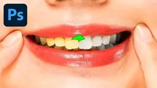 How To Whiten Teeth in Photoshop 