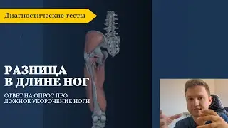 Разница в длине ног. Ложное укорочение ноги.