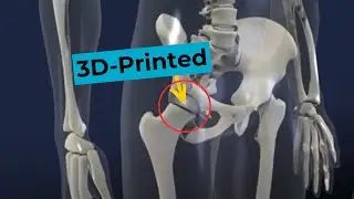 Titanium additive manufacturing layer by layer