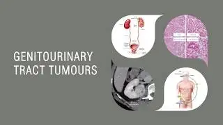 Genitourinary Tract Tumours: Essentials for Clinicians