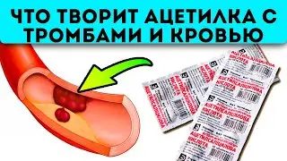 Это знают только врачи! Как ацетилка влияет на кровь, тромбоз, инсульт, вирусы...