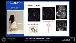 Lecture 4 - part 2: Dafna Ben Bashat - Clinical aspects of brain imaging