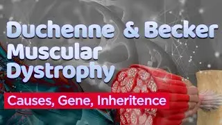 Duchenne and Becker Muscular Dystrophy | Dystrophin Gene | Progressive Loss of Muscle