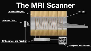 MRI Scan Animation : How magnetic resonance imaging works