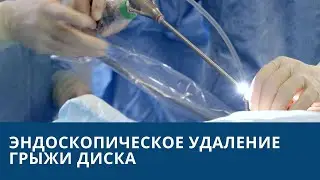 Эндоскопическое удаление грыжи диска позвоночника в Москве