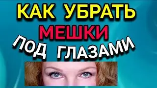 Как убрать мешки под глазами / ПРО ЖИЗНЬ / Как я похудела на 94 кг и укрепила здоровье