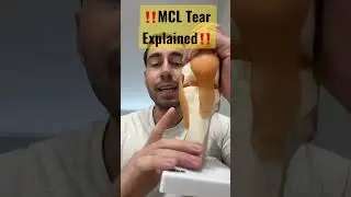 MCL Tear Explained #shorts