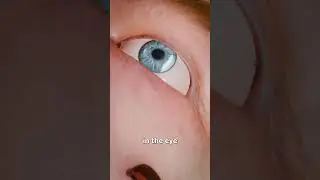 Leeches On Your Face?! 😨