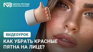 Как убрать красные пятна на лице?