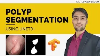 Polyp Segmentation using UNet 3+ in TensorFlow Keras