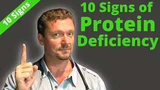 10 Hidden Signs of PROTEIN Deficiency (Watch Carefully) 2024