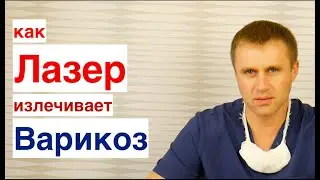 Лазер излечивает варикоз. МИФ или реальность? ЭВЛК.