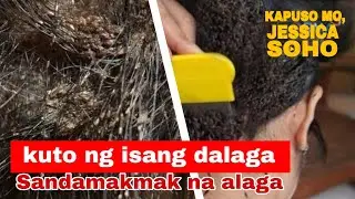 Kapuso mo, Jessica Soho: Jul 31, 2022 Kuto ng sa ulo ng isang dalaga KMJS Latest Episode