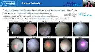 FetReg2021: Placental Vessel Segmentation and Registration in Fetoscopy Challenge Dataset