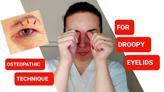 One easy OSTEOPATHIC technique for DROOPY EYELIDS