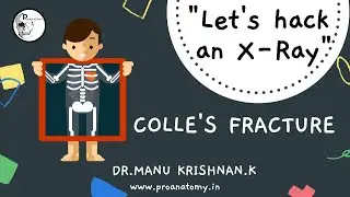 Colle's fracture - "Let's hack an X-Ray" series- Radiological Anatomy