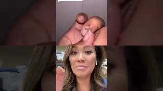 “That is so cute!” Dr Pimple Popper Reacts 🥰 