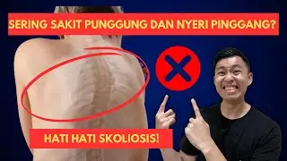 CERITA PERJUANGAN MELAWAN GEJALA PENYAKIT SKOLIOSIS!