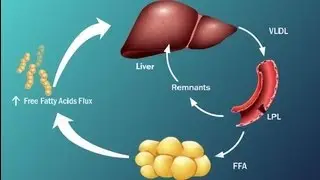 Fatty Acids and Disease in Type 2 Diabetes