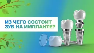 🦷 Из чего состоит зуб на импланте (имплант+абатмент+коронка)