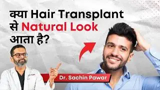 क्या Hair Transplant से Natural Look आता है? | Can You Really Achieve a Natural Look? | HairMD, Pune