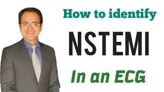 NSTEMI (Subendocardial Ischemia) ECG Changes Explained, Myocardial Infarction(MI) ECG Interpretation