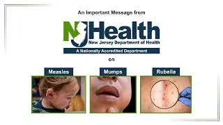 Public Service Announcement on Measles, Mumps and Rubella