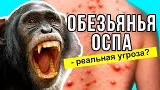 Обезьянья оспа - реальная угроза? Что такое оспа обезьян? Симптомы и последствия | Да!Но.